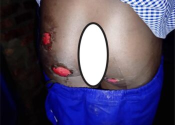 Musanze: RIB yataye muri yombi umubyeyi ukurikiranyweho guhohotera umwana we